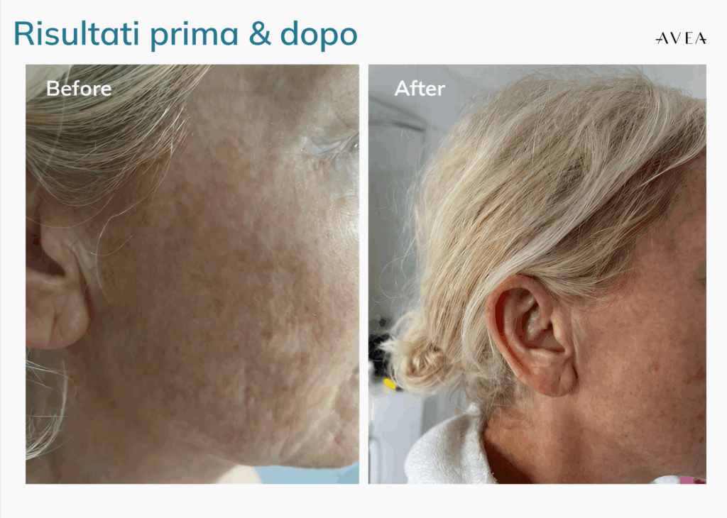 AVEA Collagen Activator esperienza